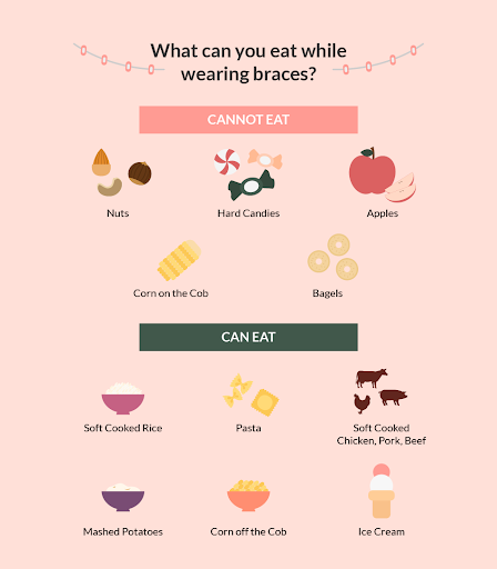 What can you eat while wearing braces
