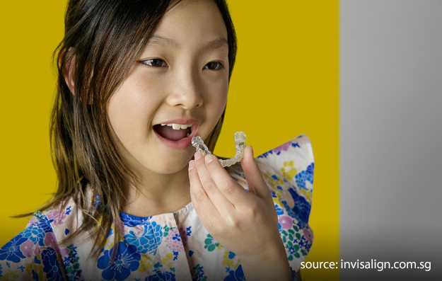 Invisalign First for Children- Invisalign Singapore