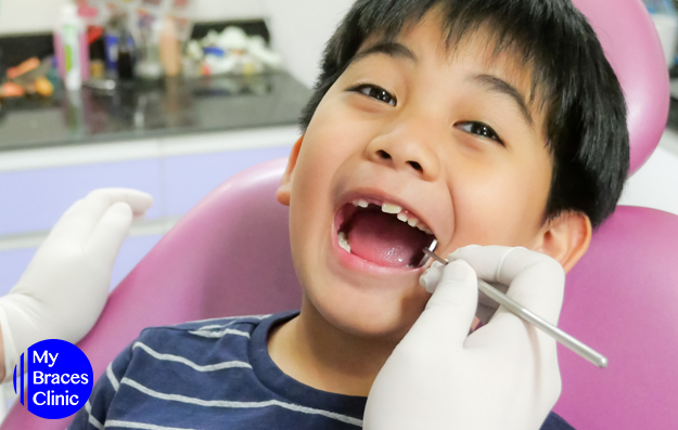 Orthodontic Treatment for Younger Children