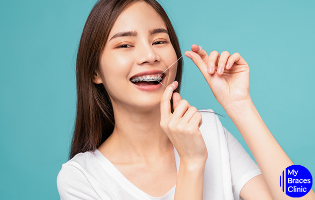Braces in Singapore Using a Dental Floss