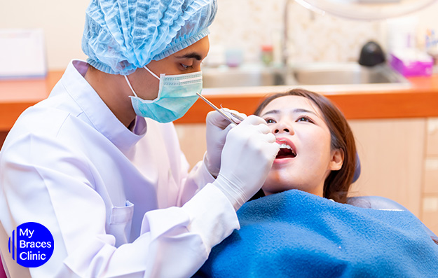 Dentist Appointment for Braces in Singapore