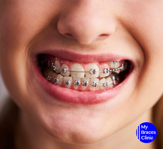 4 Problems You May Face with Orthodontic Solutions and How To Solve Them