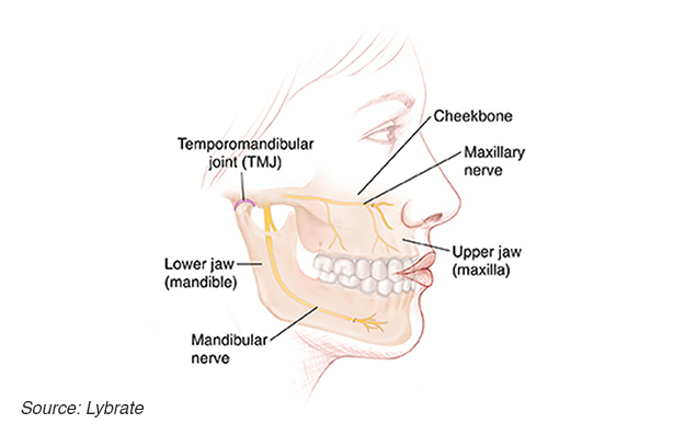Image of a jaw
