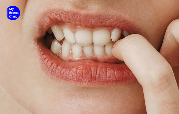 Sample image of mouth injury