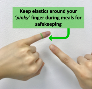 Elastics for Braces Orthodontist For Braces - MyBracesClinic