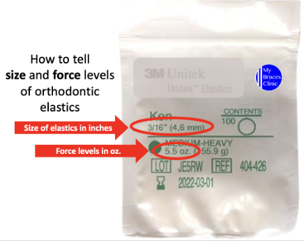 Elastics for Braces Orthodontist For Braces - MyBracesClinic