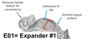 Invisalign Palatal Expander number Identifier