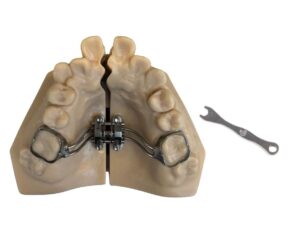 MARPE expander