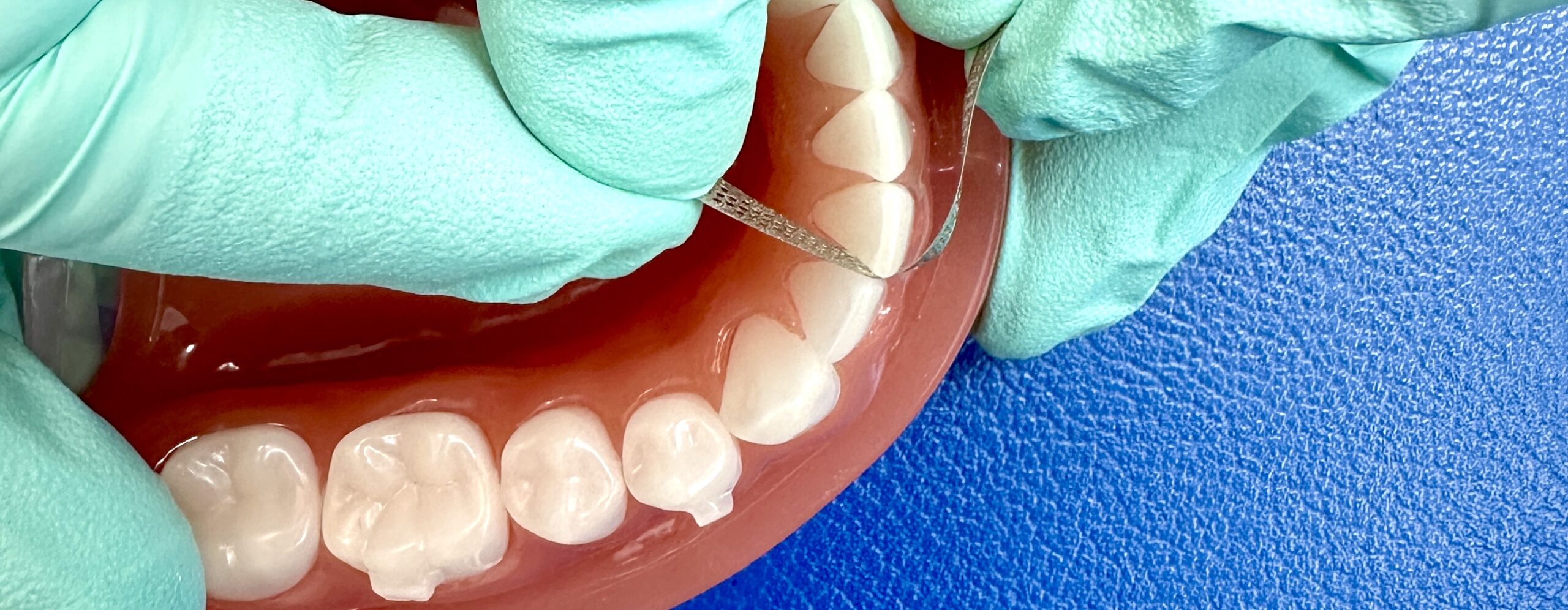 All about Interproximal Reduction (IPR) - A Complete Guide